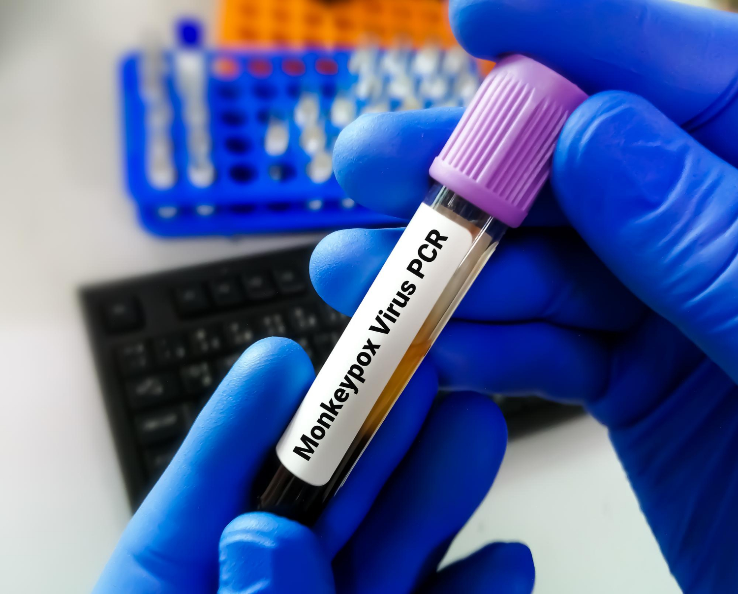 Monkeypox updates – Canada issues level-two travel notice